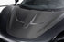 P1 Style Carbon Fiber Vented Front Hood – McLaren 720S (2017–2023) - Exotics Carbon Design